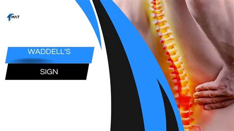 waddell compression test|waddell sign anatomy.